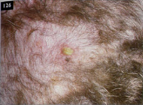 Pioderma superficial en perros