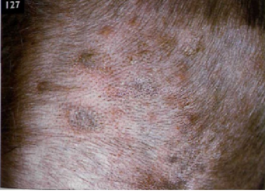 Pioderma superficial en perros