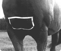 Inyeccion encapsulada en el gluteo